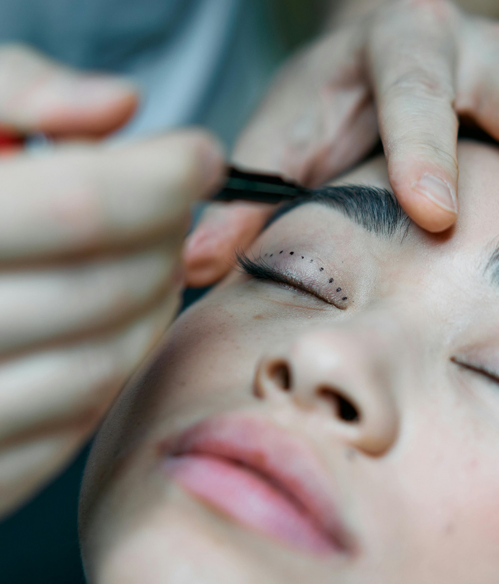 What to Expect from Eyelid Surgery at Glamorous Clinic in Islamabad