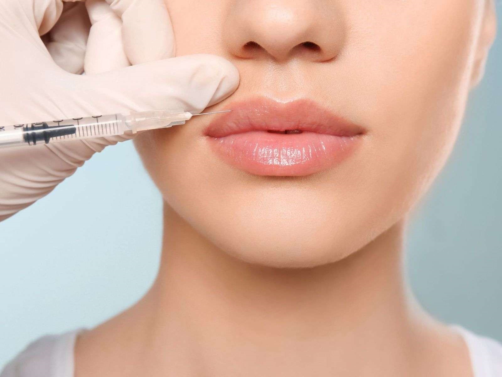 Can I lick my lips after lip fillers?
