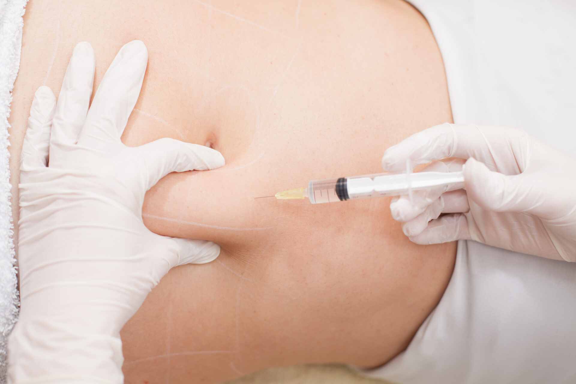 Fat Melting Injections: Dubai’s Latest Beauty Trend