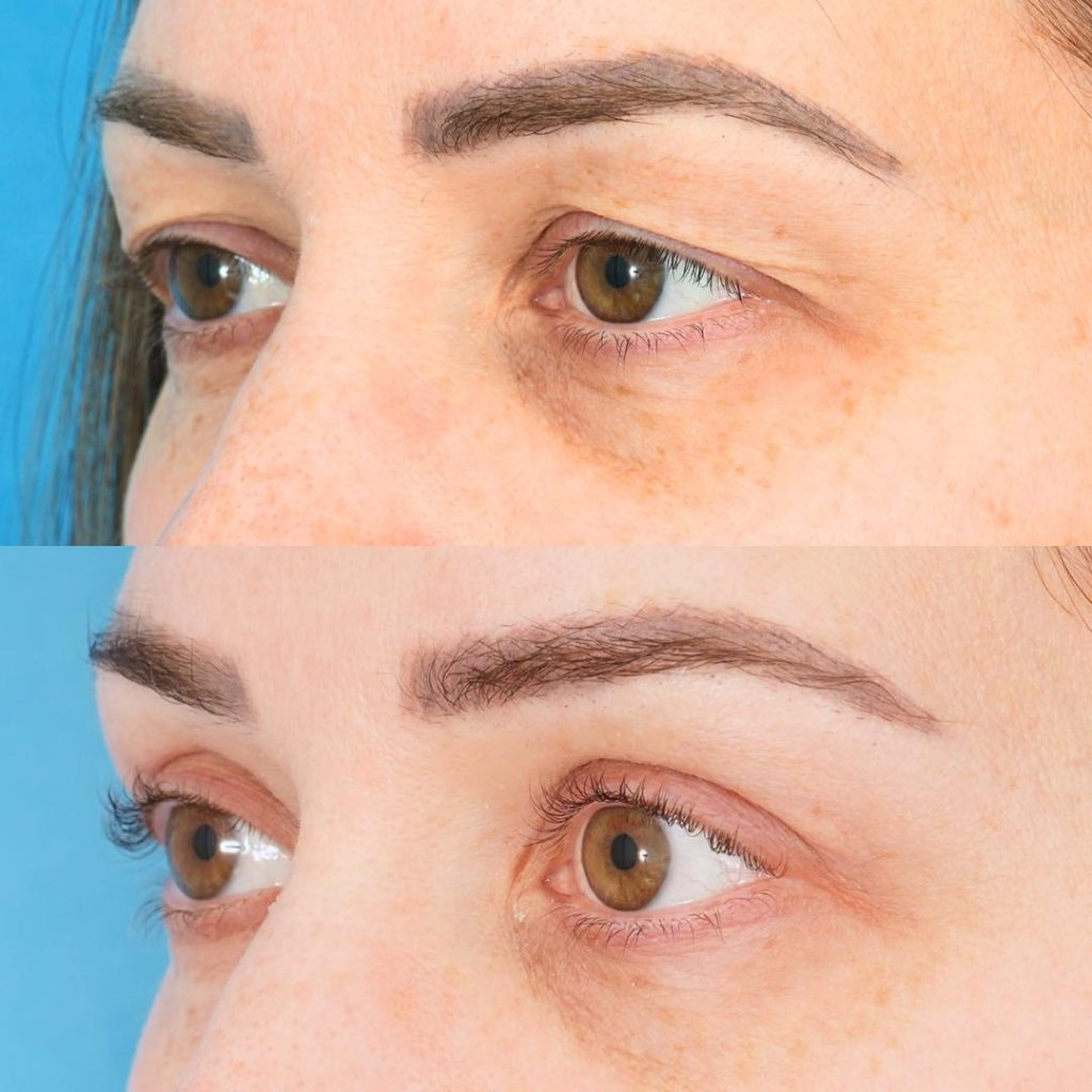 Best 7 eyelid surgeons in San Diego