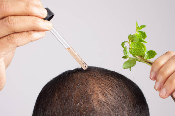 PRP Hair Treatment in Islamabad: A Revolutionary Solution for Hair Restoration