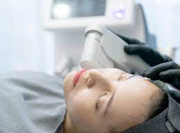 How Many Treatments of HIFU Are Typically Required in Dubai?