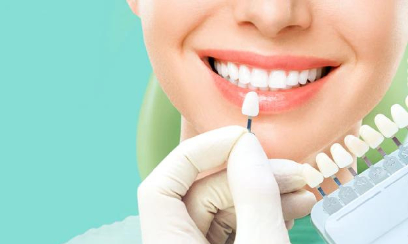 How to Fix Chipped, Stained, or Gapped Teeth with Dental Veneers