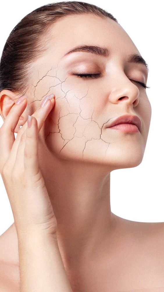 Is Scarless Acne Treatment Right for You?