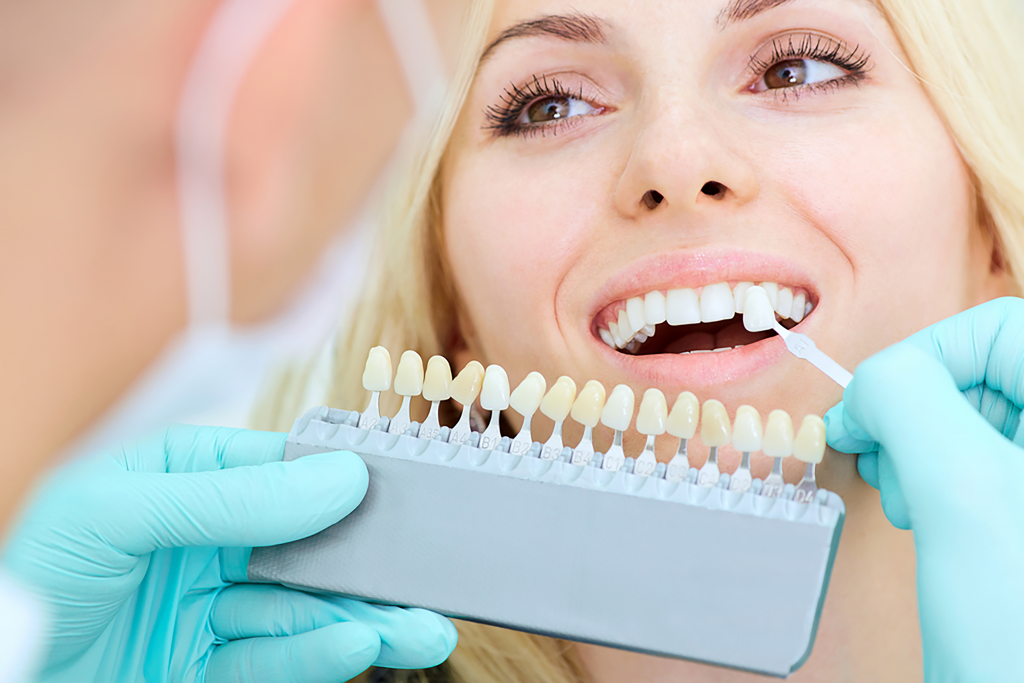 What Makes Dubai a Top Destination for Dental Veneers?