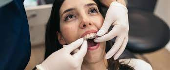 Is There a Consultation Fee for Invisalign Treatment in Dubai?