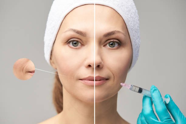 What to Expect Before, During, and After Your Glutathione Injection in Dubai