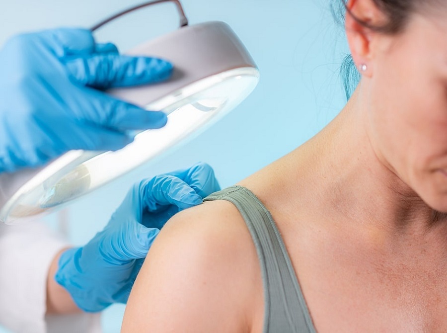 Say Goodbye to Warts: Top Treatment Methods in Islamabad