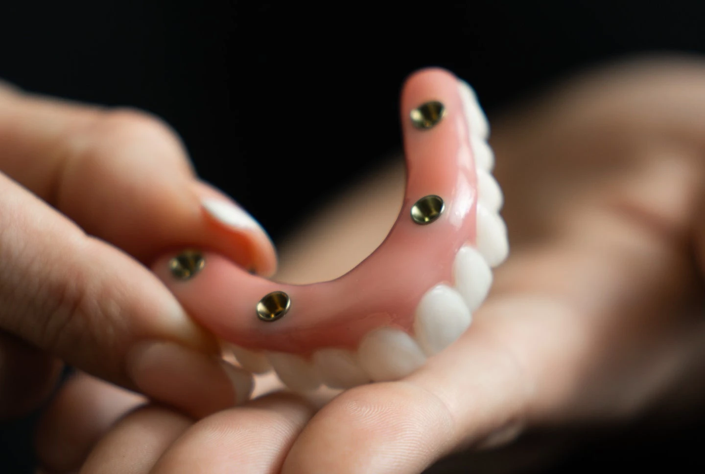 Choosing the Right Dental Implant Specialist: Tips and Advice