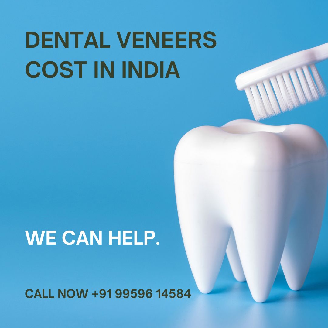 Dental Veneers Cost in India