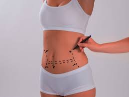 What Benefits Can a Tummy Tuck Offer?