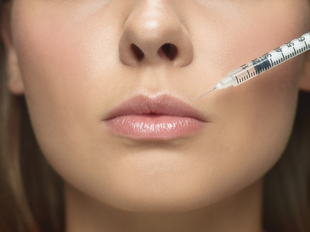 What Are Lip Fillers Injections Benefits?