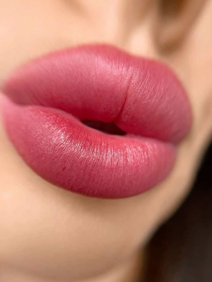 Experience the Magic of Russian Lip Fillers in Dubai