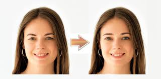 The 7 Best Forehead Lift Surgeons in San Diego