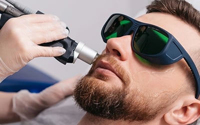What Are the Top Advantages of Male Laser Hair Removal in Dubai?