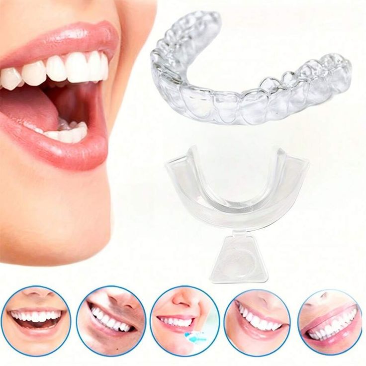 Sports Mouth Guards in Riyadh: Top Benefits for 2025