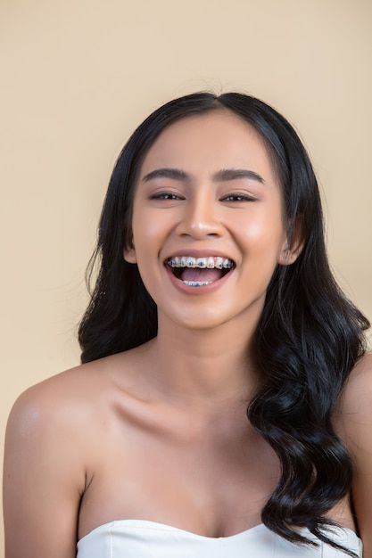 Top Benefits of Getting Braces in Riyadh in 2025
