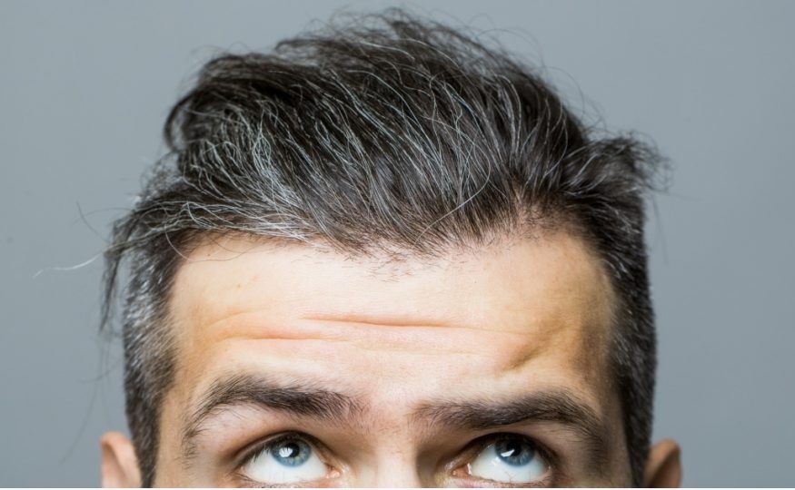 Revealing the Truth Behind Hair Systems for Men: A Complete Guide 