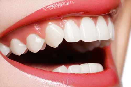 A Comprehensive Guide to Gum Contouring Treatments