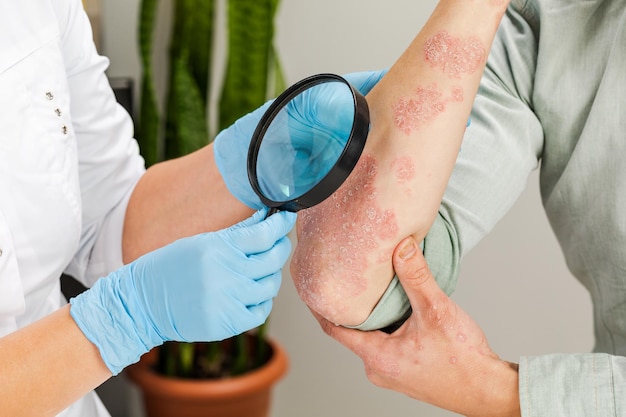 Best Dermatologists for Gentle, Non-Aggressive Acne Treatments
