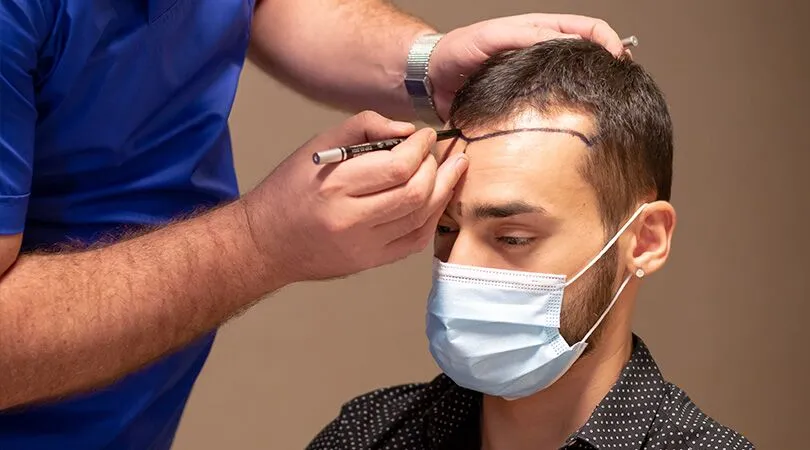 Transform Your Hair with FUE Hair Restoration