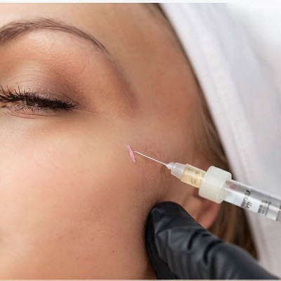 Exploring the Long-Lasting Results of Radiesse in Muscat