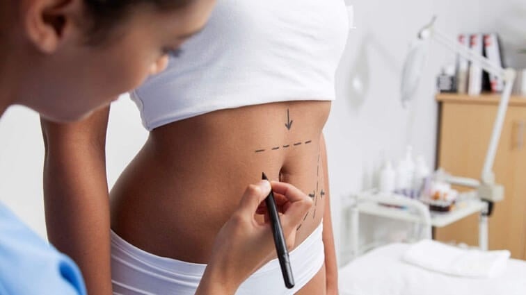 Key Insights into the Tummy Tuck Surgery Experience