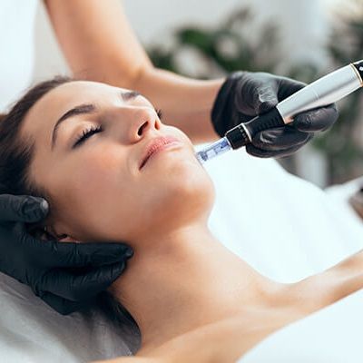 What Is Microneedling and How It Works?