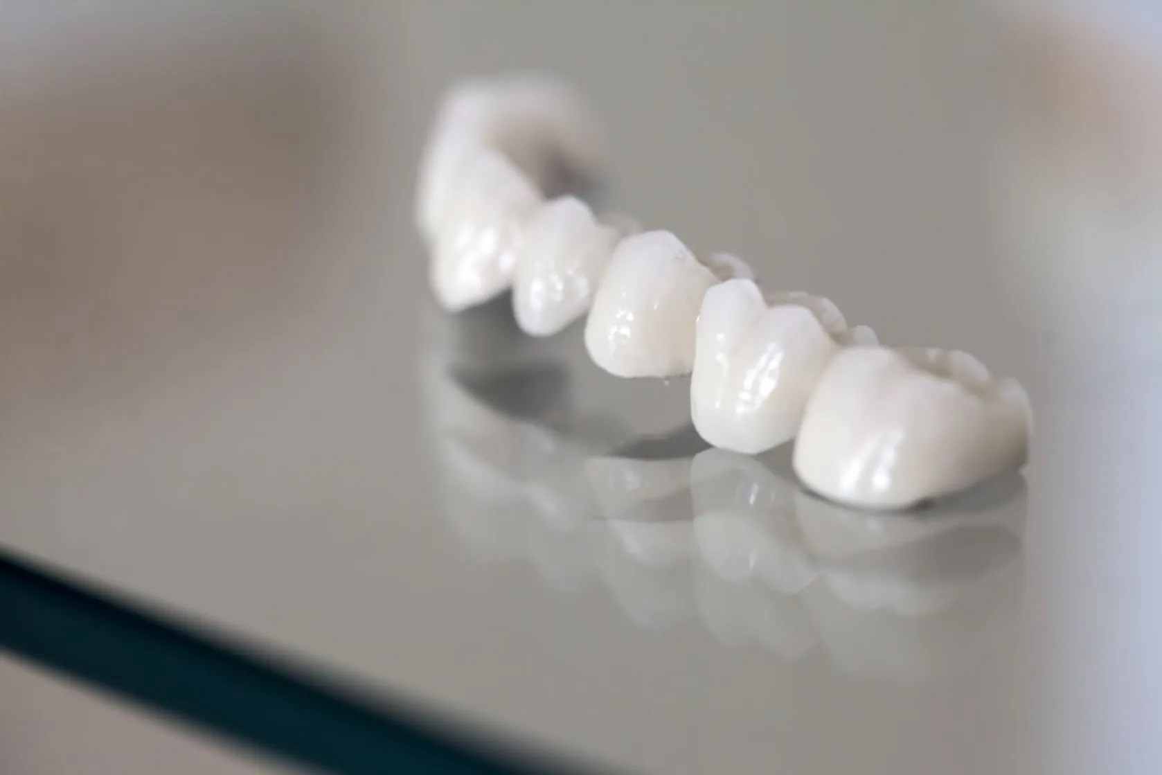 How to make dental bridges last longer?