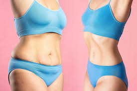 Best 5 Liposuction Clinics in Tucson, AZ