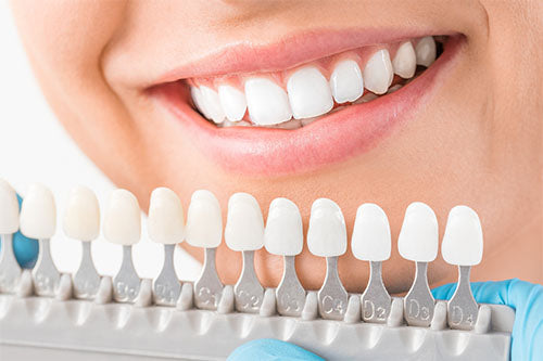 How Much Do Veneers Cost? Understanding Your Options