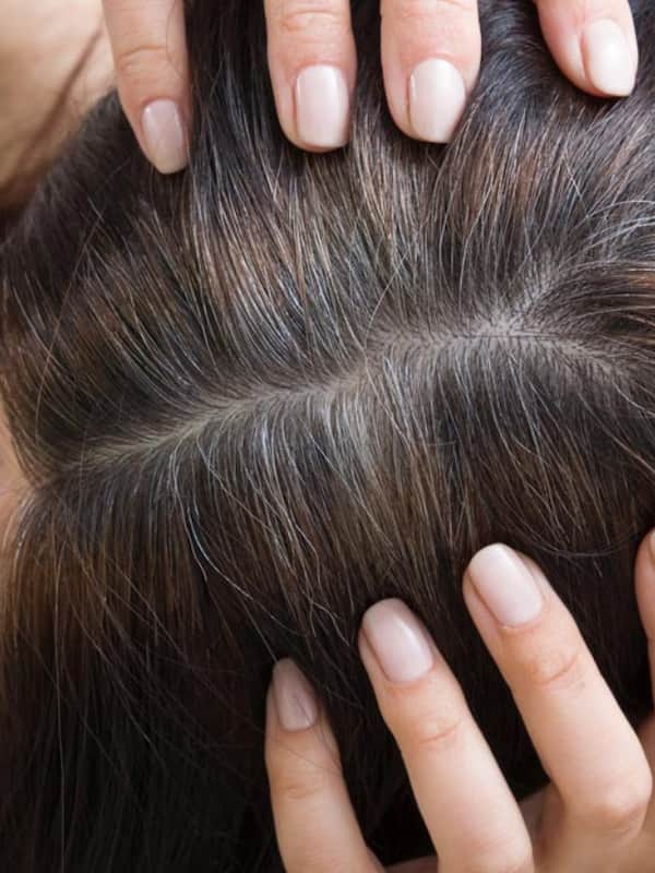 White Hair Removal and Skin Sensitivity in Dubai Tips for Safe Treatment