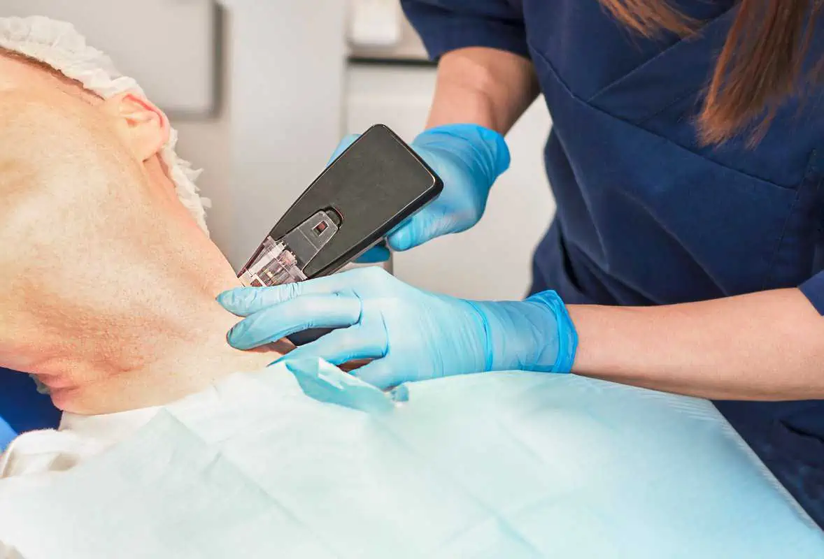 What Are the Risks of Morpheus8 Treatment in Dubai?