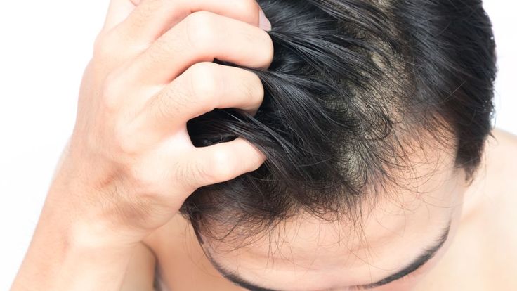Is Baldness Treatment for Males Safe for All Ages?