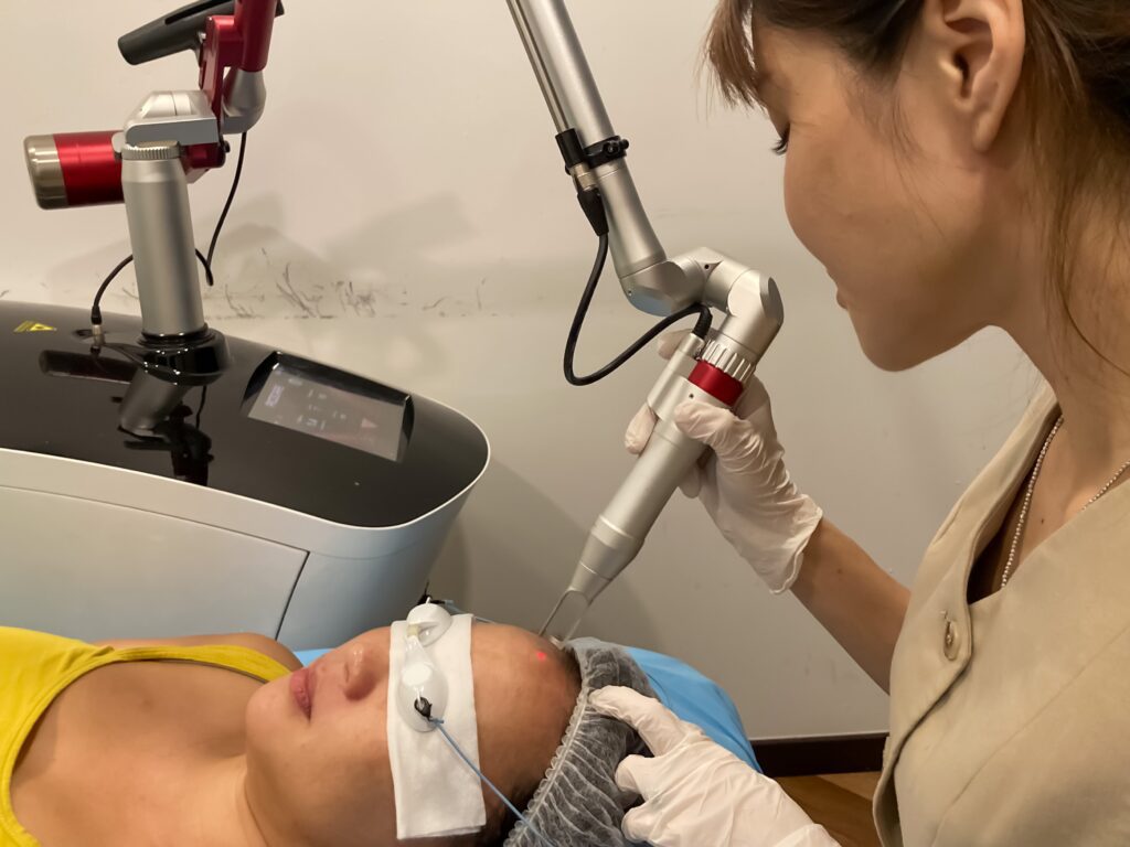 The Truth About Pico Laser Treatment: Is It Worth It?