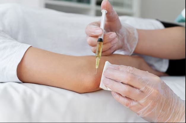 Sclerotherapy Market Share, Growth, Challenges & Global Forecast 2025-2033
