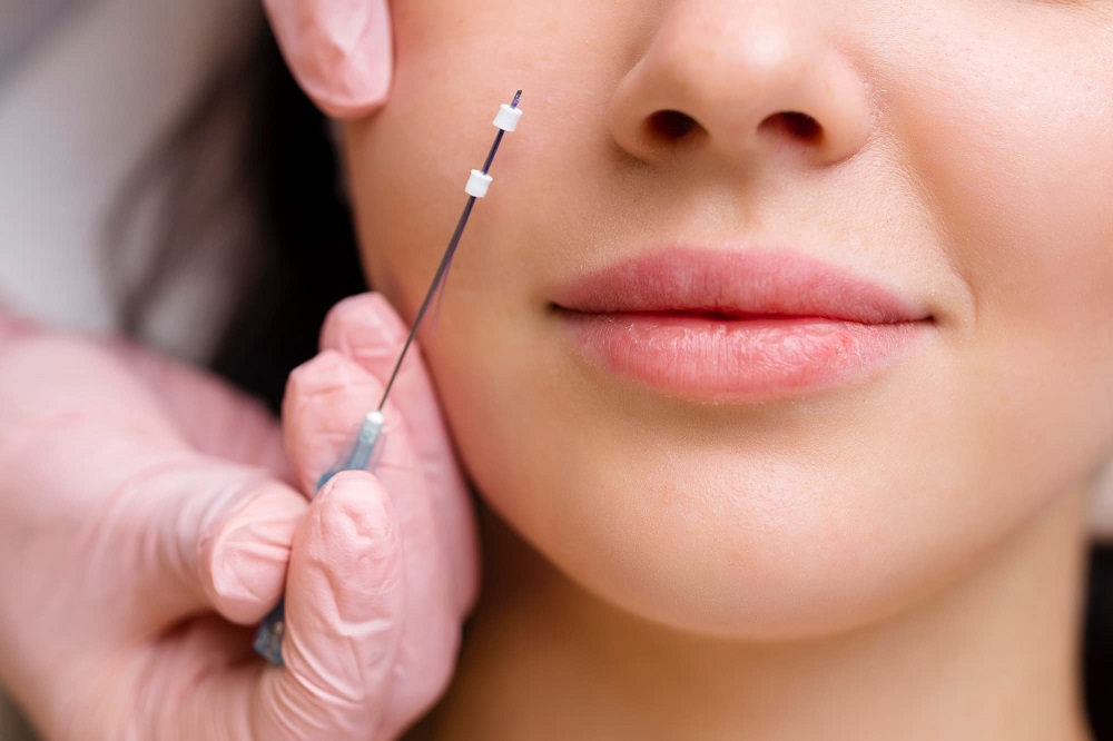 Thread Lift in Islamabad: Glamorous Clinic’s Expertise Explained