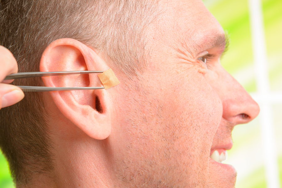 What Are Ear Acupuncture Points and How Do They Work?