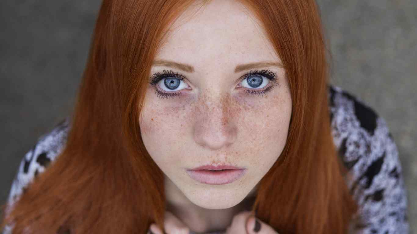 What are Freckles and how to avoid them?