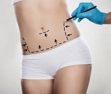 Comprehensive Guide to Cosmetic Surgery in Delhi: Transforming Lives with Expert Care
