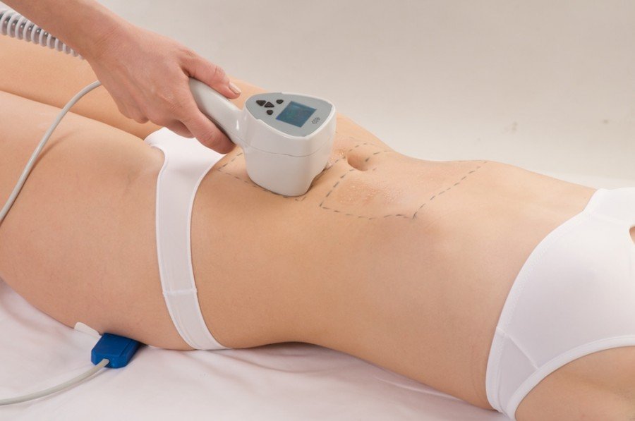 The Science of Radiofrequency Energy and Its Role in Fat Reduction and Skin Tightening