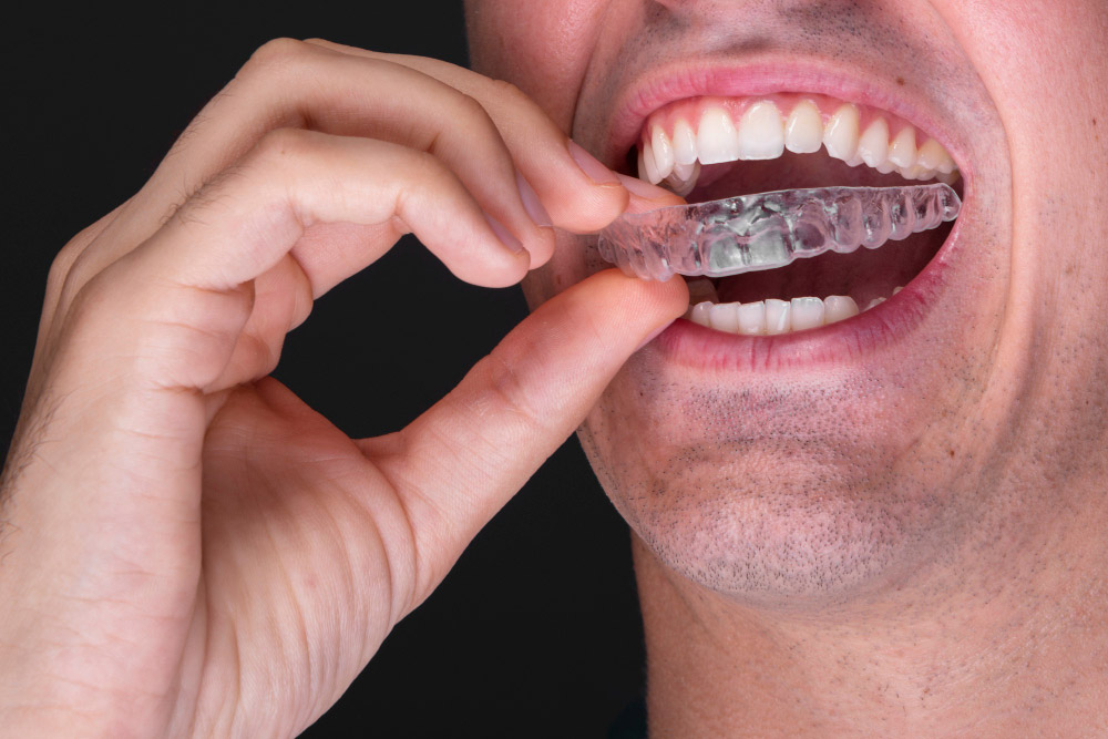 Shield Your Teeth from Bruxism Damage