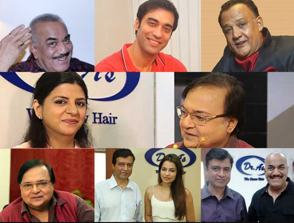 Celebrities Hair Transplant in Delhi | Hair Transplant in India