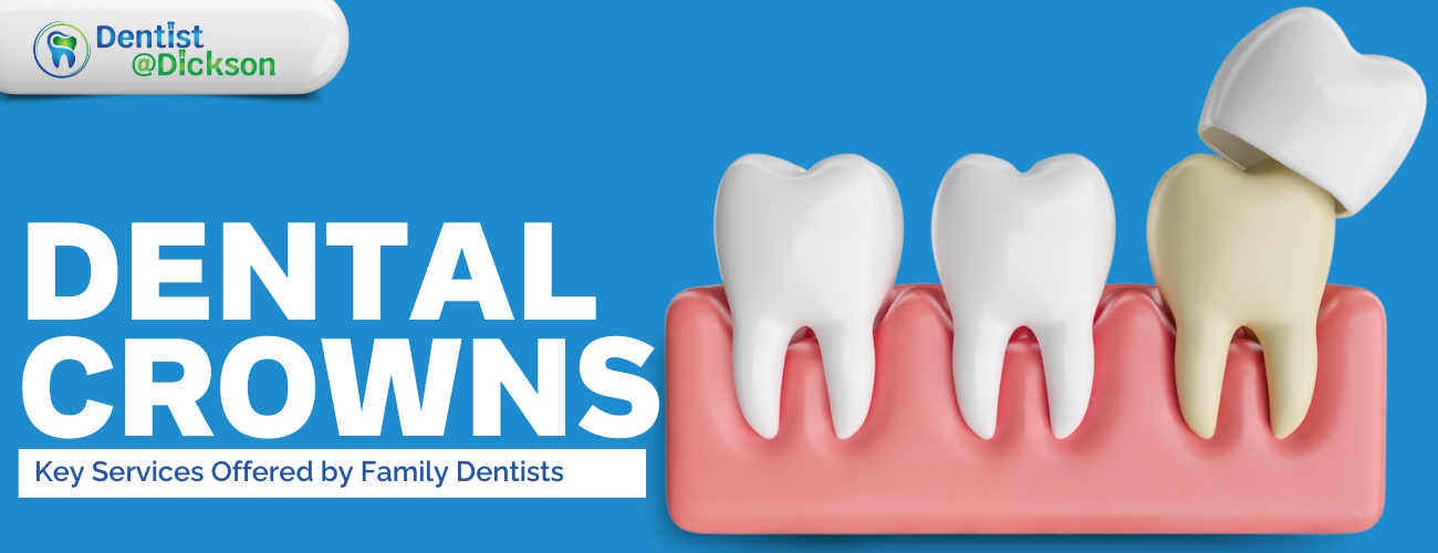 Dental Crowns and Beyond: Key Services Offered by Family Dentists