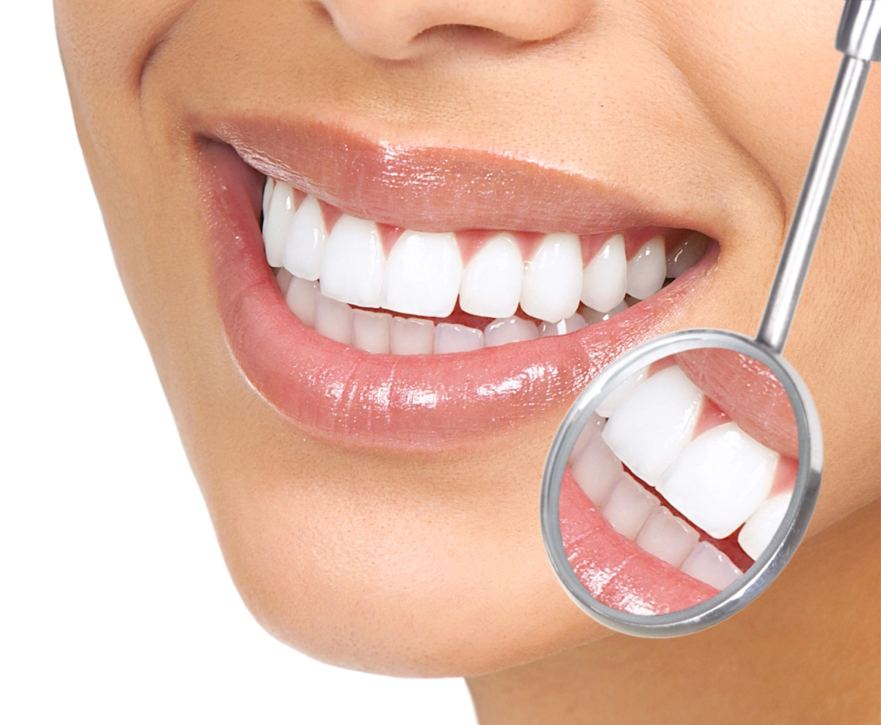 Non-Prep Veneers for Sensitive Teeth: A Gentle Smile Enhancement