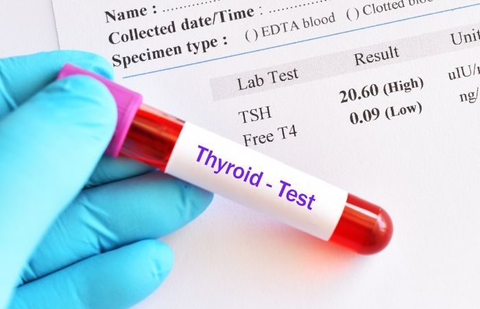 Thyroid Function Tests: Symptoms That Indicate You Should Get Tested