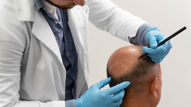 Is the High Cost of Hair Transplants in Dubai Justified?