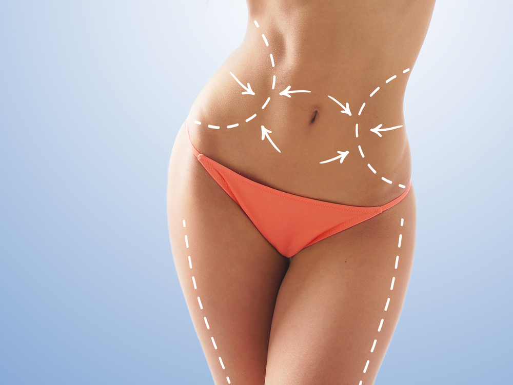 The Benefits of a Tummy Tuck Transforming Your Body and Confidence