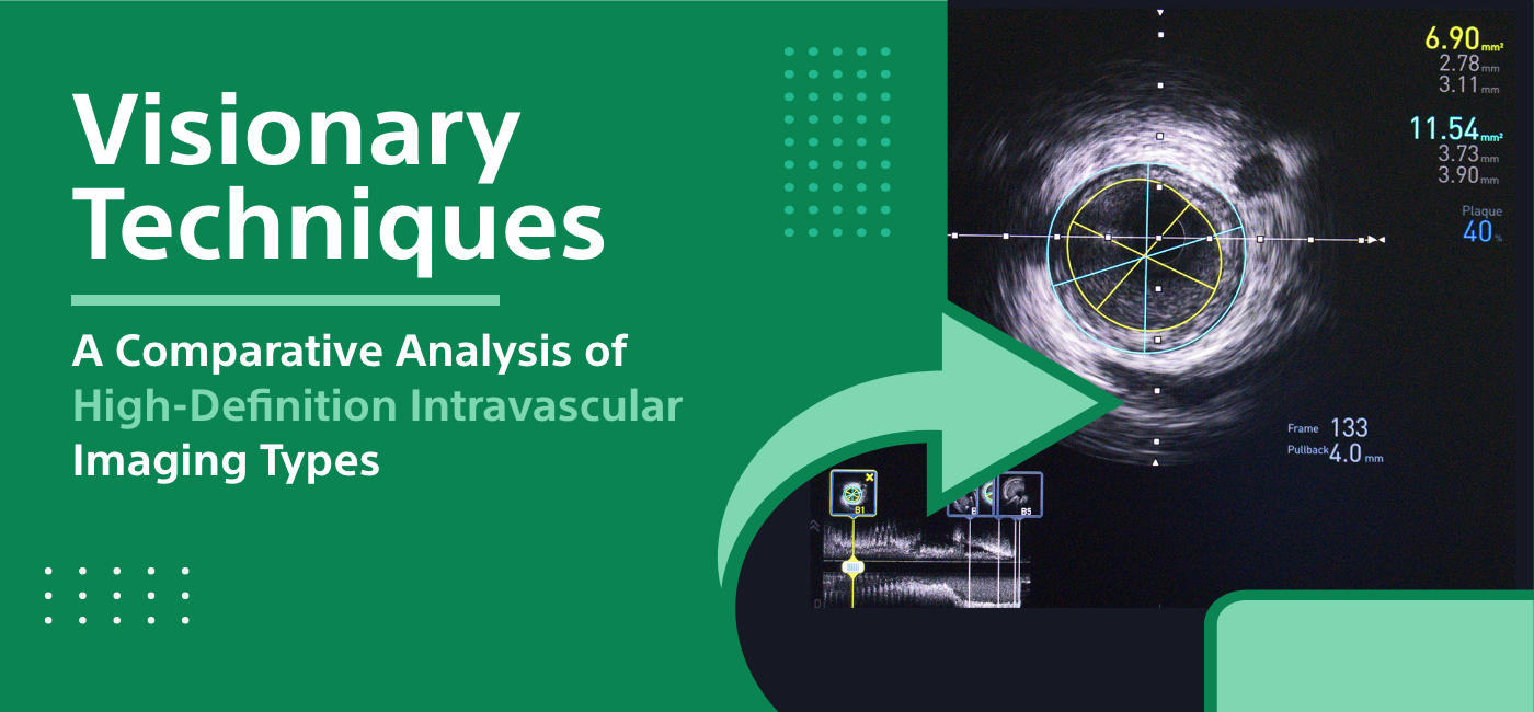 A Comparative Analysis of High-Definition Intravascular Imaging Types