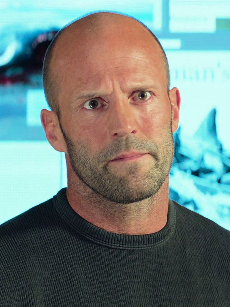 How Long Does a Hair Transplant Procedure Actually Take?